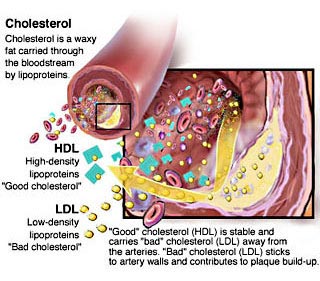 Cholesterolin BloodstreamPhoto