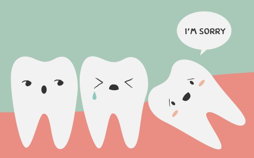 wisdom-teeth-1.jpg